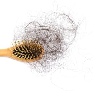 Treatments for Hair Loss