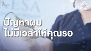 Alopecia in Male and Female