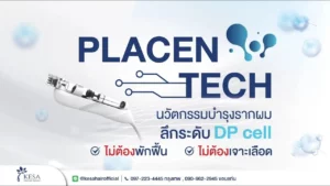 PlacenTech is an innovation of DP Cell stimulation