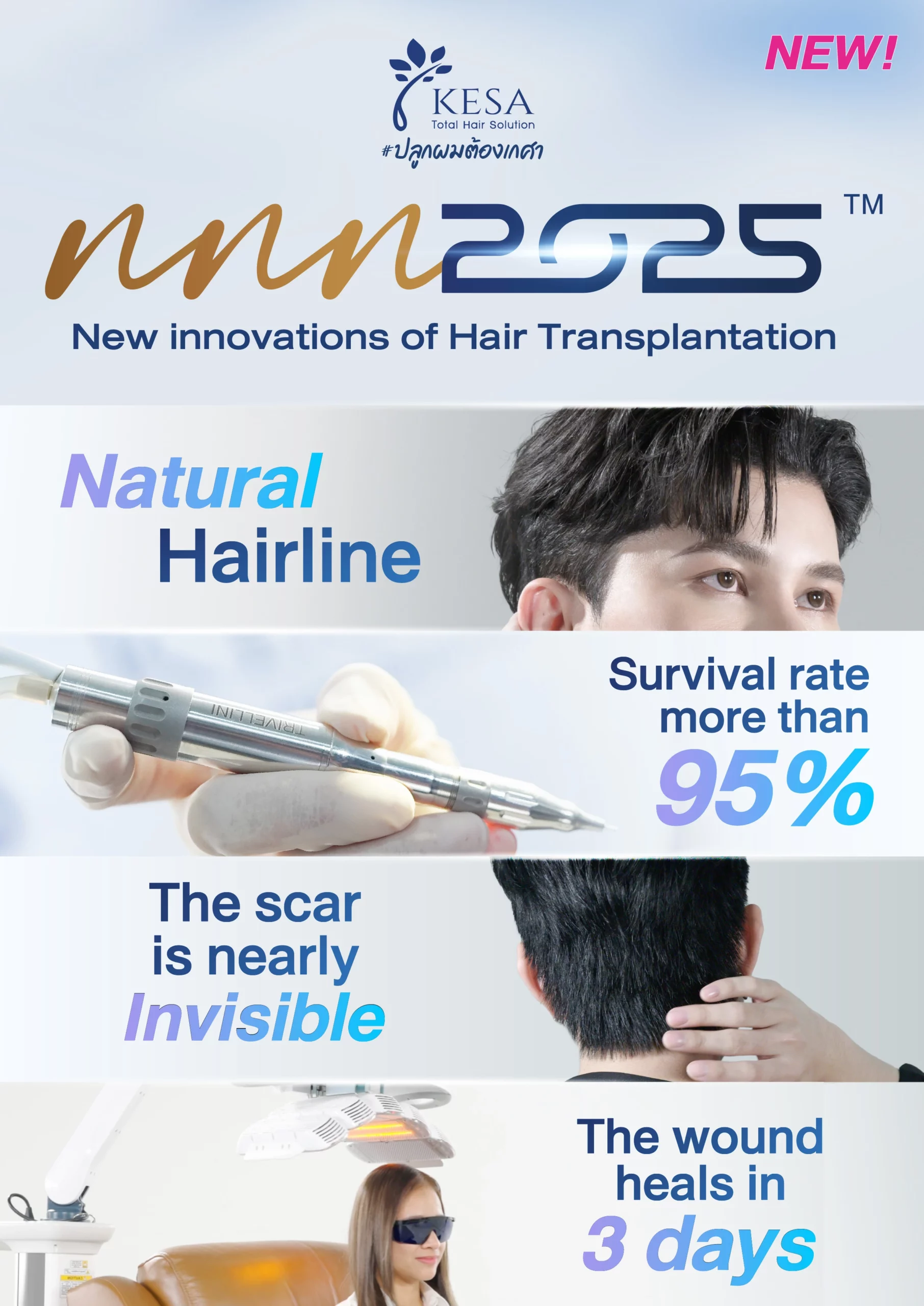 High Technology hair transplant